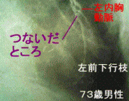 Y氏の術後1年後の造影画像2